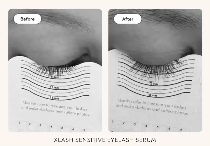 Före- och efterbilder som visar hur fransarna växer med Xlash prostaglandin. Mätning visar tydlig längdökning.