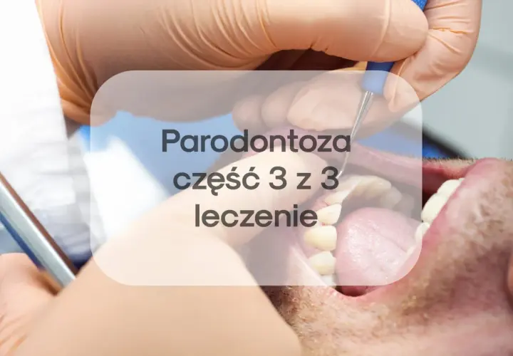 Leczenie paradontozy laserem to nowoczesna metoda. Sprawdź, jaka jest laserowe leczenie paradontozy cena i jak przebiega zabieg.