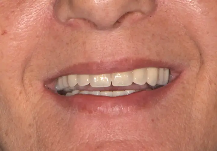 Un sorriso smagliante, ma attenzione: il tè macchia i denti.
