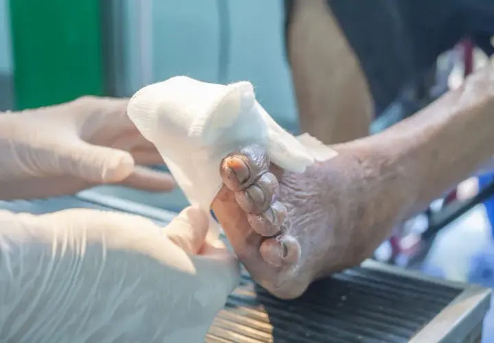Skuteczne metody na ból neuropatyczny, które przynoszą ulgę