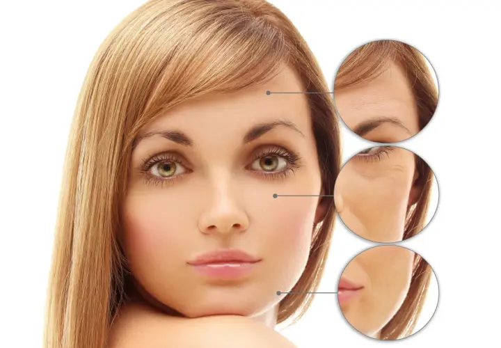 Kvinnas ansikte med närbilder som visar rynkor före och efter behandling med retinoid eller retinol.