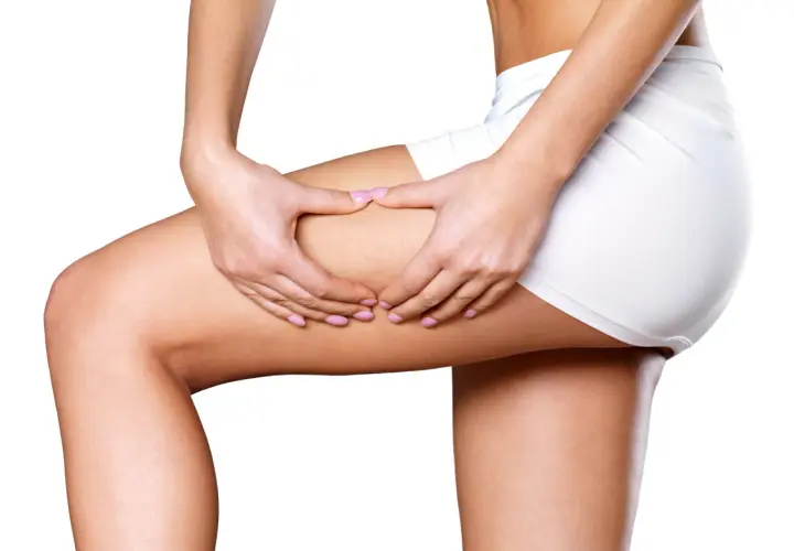 Woman's hands pinching thigh, showing skin texture.