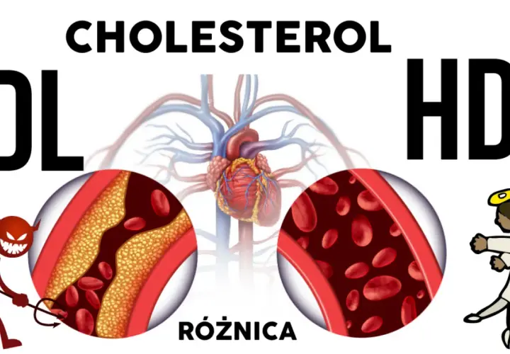 Dobry czy zły cholesterol? Rozróżnij HDL i LDL i zadbaj o serce!