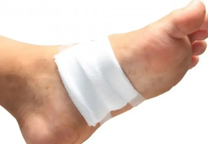 Un pansement blanc est appliqué sur le dessus du pied, suggérant la question : faut il mettre un pansement sur une brûlure ?