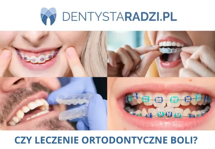 Ból zębów od aparatu ortodontycznego? 7 metod na szybką ulgę.
