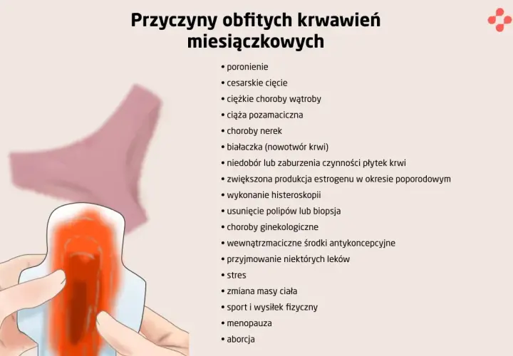 Obfite krwawienia miesiączkowe i skrzepy mogą mieć różne przyczyny, od chorób po stres.