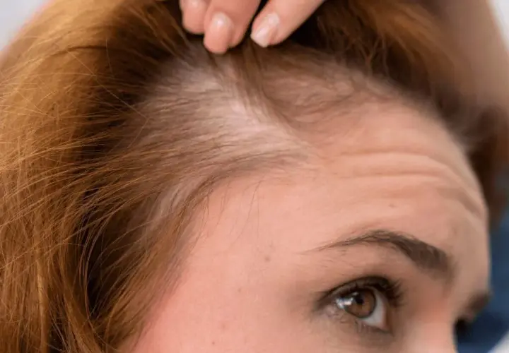 Primer plano de una mujer revisando su cuero cabelludo, preocupada por evitar la caída del cabello.