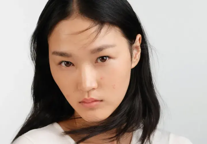 Jeune femme au visage marqué par des imperfections. Elle cherche des solutions sur que faire contre la peau grasse.