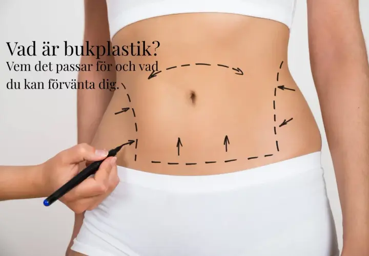 En hand markerar med penna en linje runt en mage, som visar området för en bukplastik. Texten frågar "Vad är bukplastik?".
