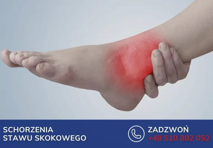 Ból stopy i kostki, zaczerwienienie sugerujące zapalenie pochewki ścięgna. Skontaktuj się w celu leczenia schorzeń stawu skokowego.