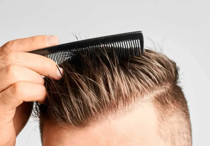 Hombre peinando su cabello, buscando recuperar pelo entradas naturalmente.