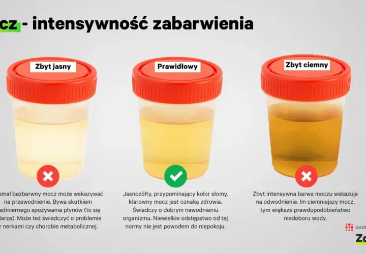 Obraz pokazuje trzy pojemniki z moczem o różnym zabarwieniu: zbyt jasnym, prawidłowym i zbyt ciemnym. Zbyt jasny mocz może wskazywać na przewodnienie lub problemy z nerkami. Prawidłowy mocz jest jasnożółty i świadczy o dobrym nawodnieniu. Zbyt ciemny m...