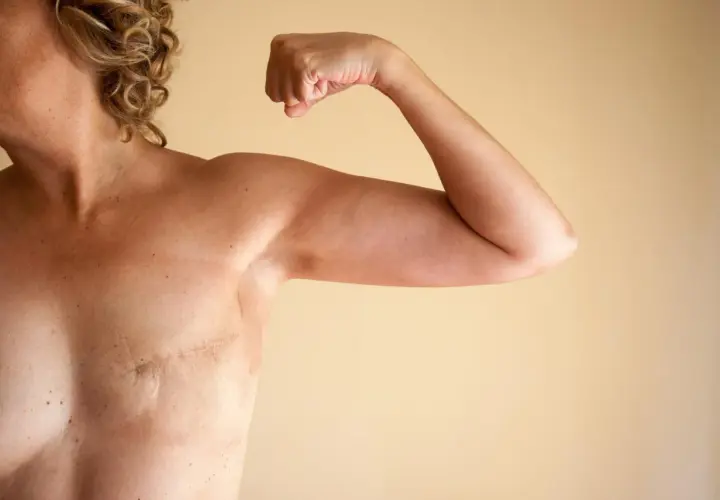 Silna kobieta po mastektomii piersi pokazuje bliznę i biceps. Siła i odwaga po walce.