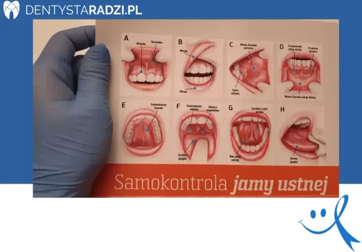 Rak dziąseł: objawy. Czy Twoje dziąsła mówią Ci coś ważnego?