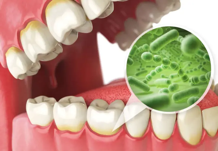 Ingrandimento del microbiota orale: batteri verdi su sfondo verde, con denti ingialliti in primo piano.