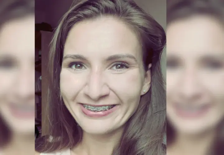 Kiedy trzeba nosić aparat na zęby? Zobacz, co musisz wiedzieć