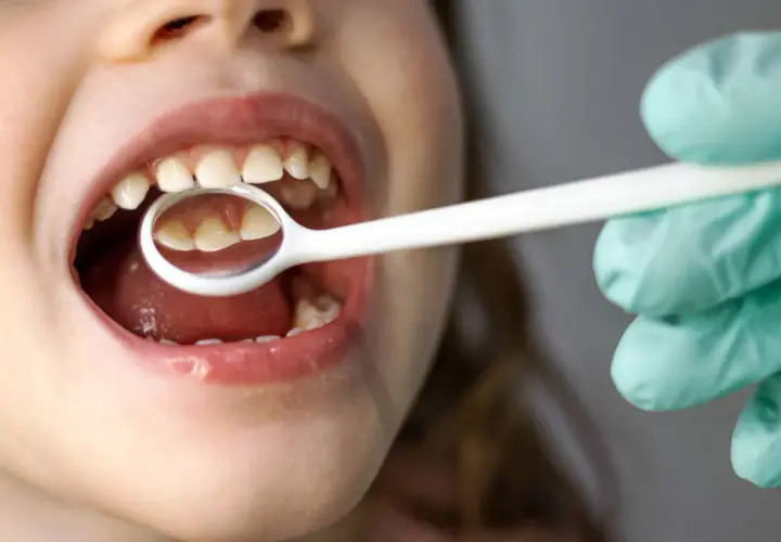 Bocca di un neonato con ciuccio, mentre un dentista esamina i suoi dentini con uno specchietto.