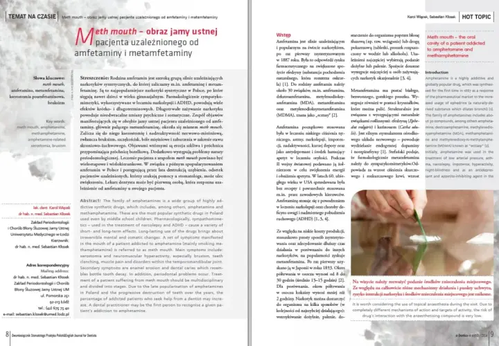 Amfetamina a zęby: Jak rozpoznać i leczyć "meth mouth"?