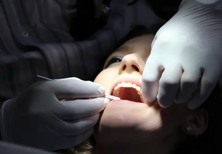 Dentysta w białej rękawiczce wykonuje zabieg zatruwania zęba u pacjentki.
