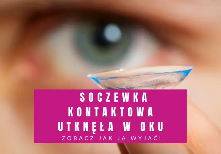 Co zrobić jak soczewka utknie w oku - skuteczne metody usunięcia