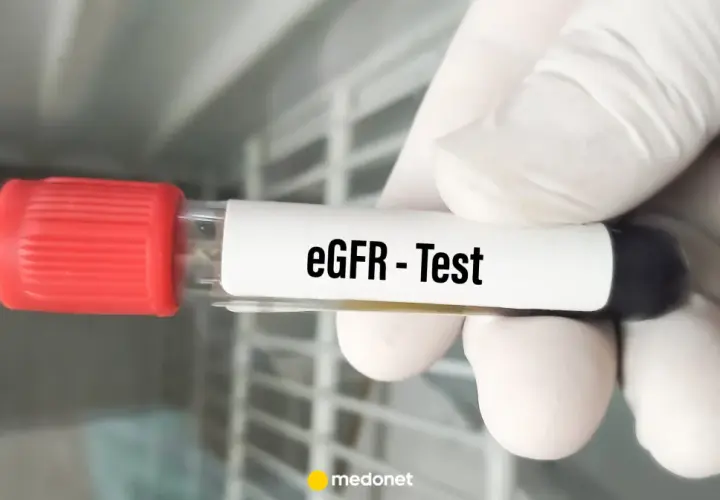 Rękawiczka trzyma probówkę z napisem "eGFR - Test". To badanie ocenia funkcję nerek.