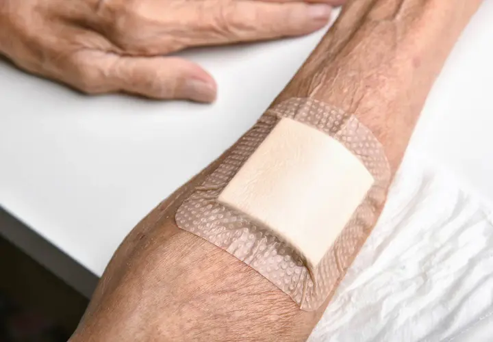 Plaster na odleżyny ze srebrem na przedramieniu osoby starszej. Dbałość o skórę i komfort.