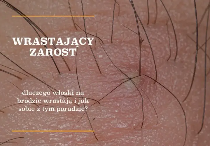 Kiedy rośnie zarost? Wiek, etapy i indywidualny rozwój