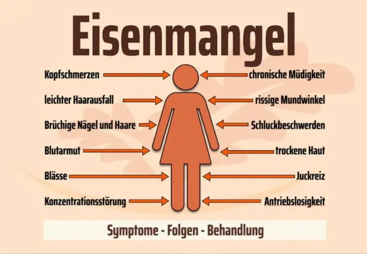 Eisenmangel kann zu Kopfschmerzen, Müdigkeit, Haarausfall und trockener Haut führen. Die Grafik zeigt Symptome wie Blutarmut und Konzentrationsstörungen.