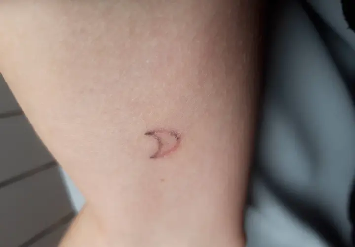 Wypadanie tuszu z tatuażu: Kiedy to norma, a kiedy problem?