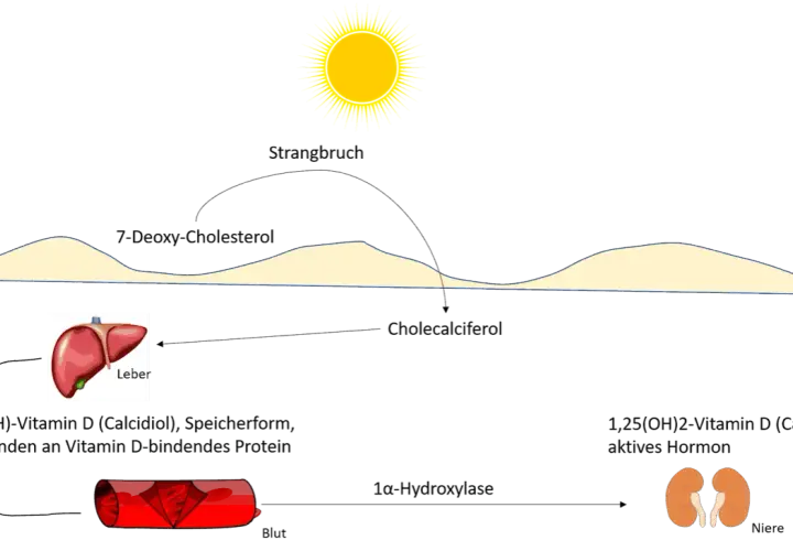 Vitamin D Mangel: Ursachen, Symptome und effektive Lösungen für Ihre Gesundheit