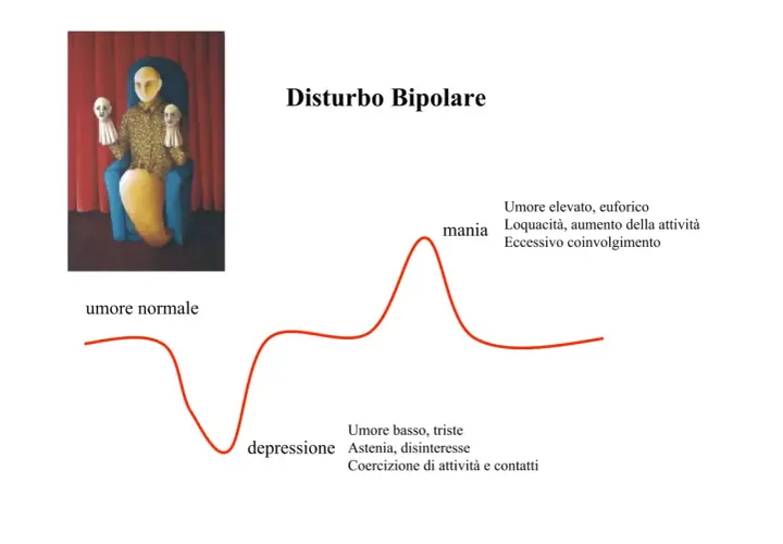 Illustrazione del disturbo bipolare tipo 1: un grafico mostra fluttuazioni dell'umore tra mania ed euforia e depressione, con un'immagine simbolica di una figura seduta con maschere.