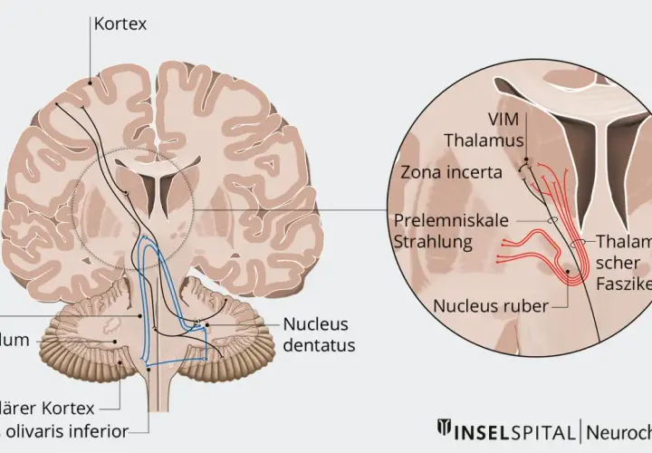 Hirnschnitt mit Darstellung von Nervenbahnen, die vom Kortex zum Thalamus und Kleinhirn verlaufen. Der primäre Fokus liegt auf dem Thalamus und seinen Verbindungen.