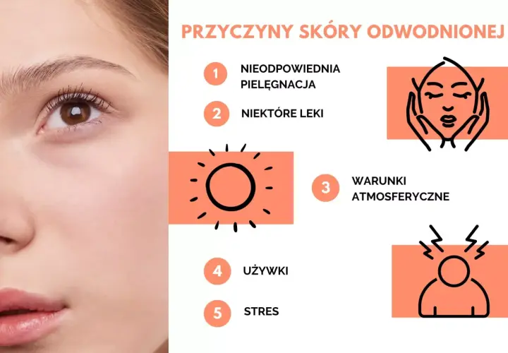 Przyczyny odwodnionej skóry: niewłaściwa pielęgnacja, leki, warunki atmosferyczne, używki, stres. Obraz pokazuje fragment twarzy i listę czynników.