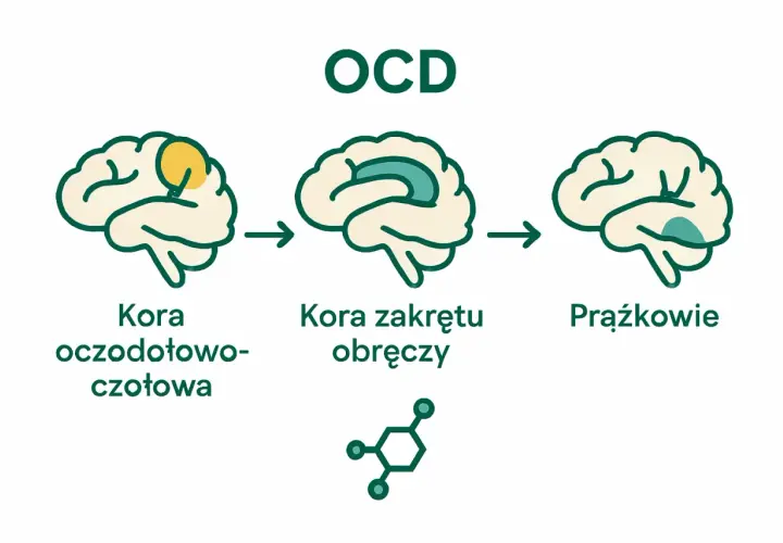 Ilustracja pokazuje mózg z zaznaczonymi obszarami, które mogą być związane z ocd objawy: kora oczodołowo-czołowa, kora zakrętu obręczy i prążkowie.