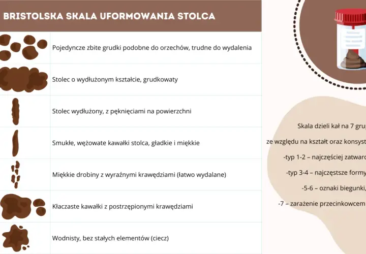 Bristolską skalą uformowania stolca opisano 7 typów, od twardych grudek (zatwardzenie) po wodnisty (biegunka).