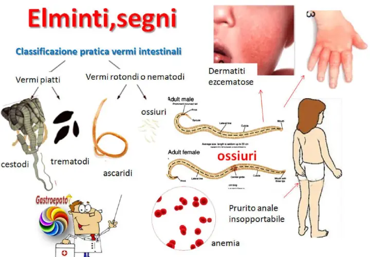 Immagine illustra vermi intestinali e i loro sintomi: dermatiti, prurito anale, anemia.