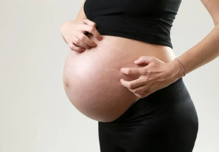Ciężarna kobieta drapie brzuch, co może być jednym z objawów cholestazy ciążowej.