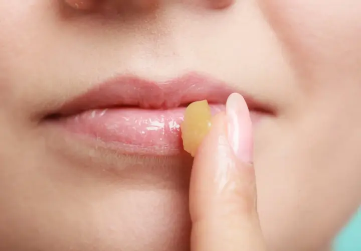 Dita applica un balsamo sulle labbra, un rimedio della nonna per labbra infiammate.