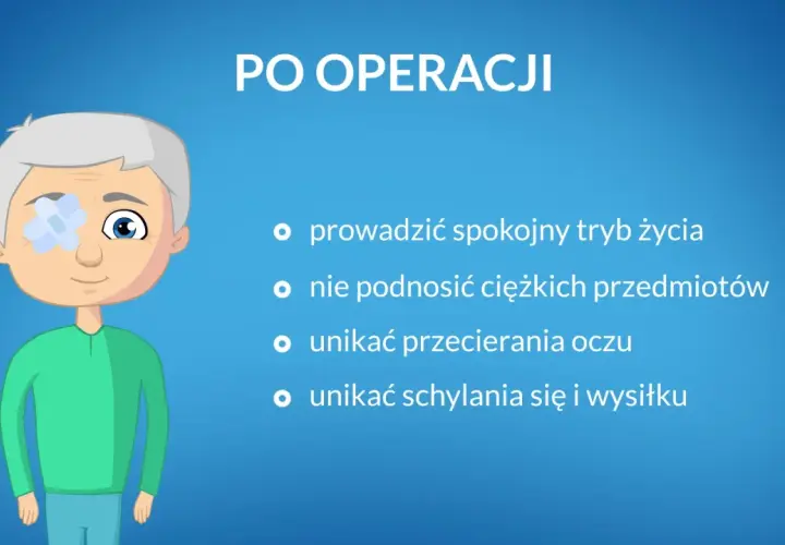 Zalecenia po operacji zaćmy: uniknij najczęstszych błędów w pielęgnacji