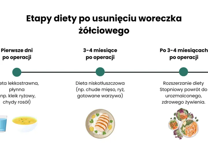 Etapy diety po usunięciu woreczka żółciowego: płynna, niskotłuszczowa, a potem stopniowy powrót do zdrowego żywienia.