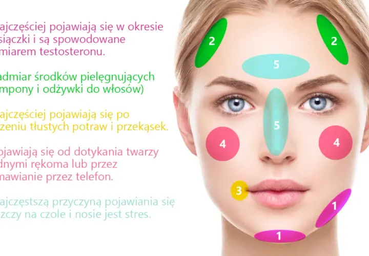 Pryszcze na policzkach: Co oznaczają i jak skutecznie walczyć?