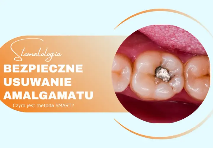 Bezpieczne usuwanie plomb amalgamatowych. Zbliżenie na zęby z widoczną starą plombą.