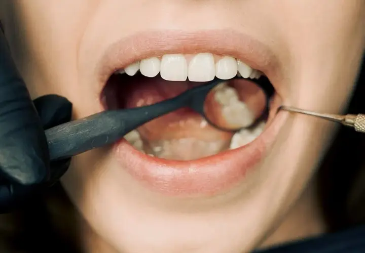 Antybiotyk na ząb z ropą: Co działa i kiedy do dentysty?