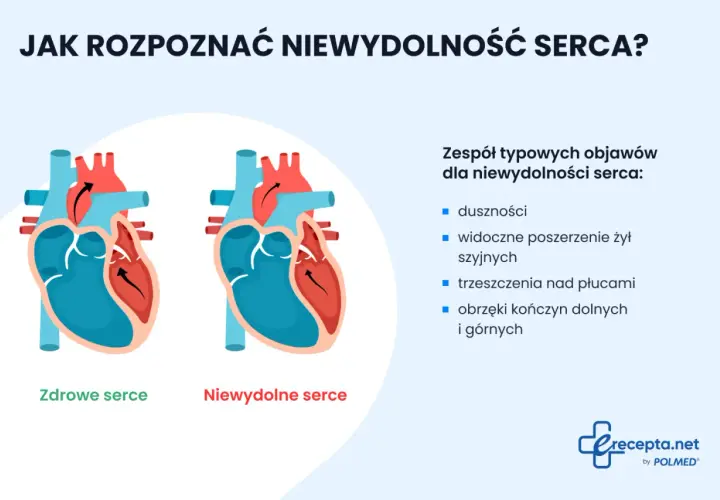Porównanie zdrowego i niewydolnego serca. Objawy niewydolności serca: duszności, obrzęki, trzeszczenia nad płucami.