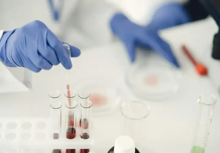 Badacz w niebieskich rękawiczkach pobiera próbkę krwi do analizy. Może to być związane z diagnostyką mykoplazma objawy.