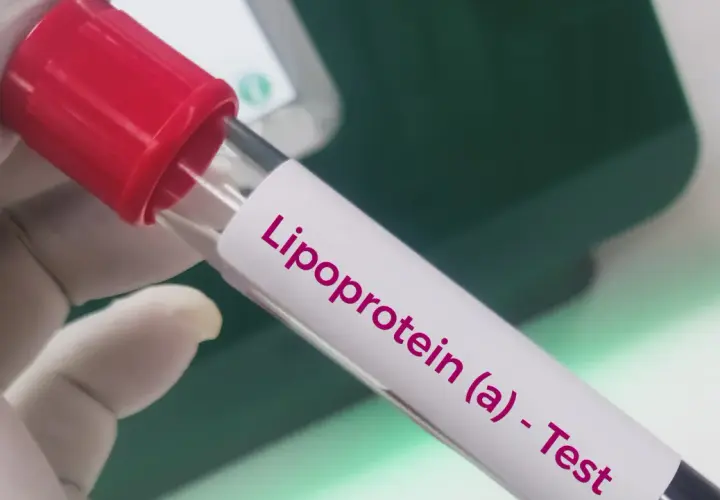 Rękawiczka laboratoryjna trzyma probówkę z napisem "Lipoprotein (a) - Test". To badanie ocenia poziom lipoproteiny (a), ważnego markera ryzyka sercowo-naczyniowego.