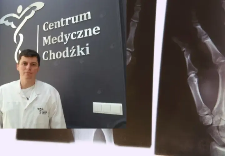 Lekarz w białym fartuchu na tle logo Centrum Medyczne Chodźki i zdjęcia RTG dłoni.