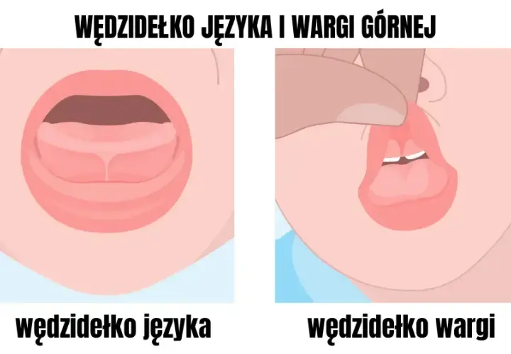 Podcięcie wędzidełka: Kiedy ćwiczyć, a kiedy sport? Poradnik