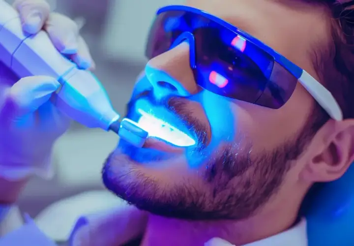 Mężczyzna w okularach ochronnych przechodzi zabieg wybielania zębów u dentysty. Dowiedz się, jaka jest wybielanie zębów u dentysty cena.