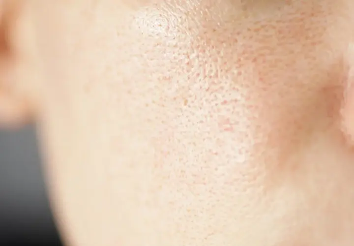 Zbliżenie na skórę twarzy, ukazujące widoczne pory. To naturalne otwory, przez które skóra oddycha i wydziela sebum.